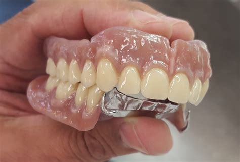 Denture Teeth Overview